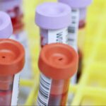 Blood samples in case